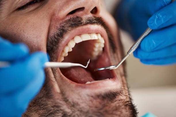 Best Emergency Care for Gum Disease in Marion, KS