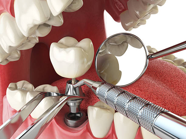 Best After-Hours Dental Care in Marion, KS