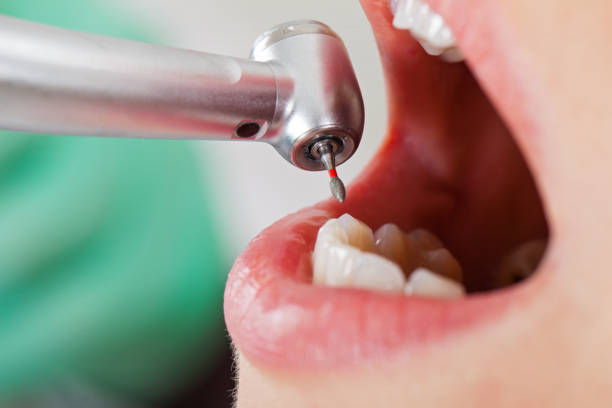 Best Urgent Dental Care for Toothaches in Marion, KS